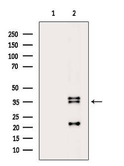 Invitrogen SLC25A11 Polyclonal Antibody 100 &mu;L; Unconjugated:Antibodies,