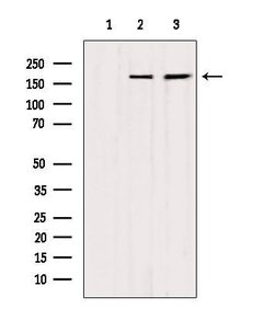 Invitrogen MYOM2 Polyclonal Antibody 100 &mu;L | Buy Online | Invitrogen&trade; | Fisher Scientific