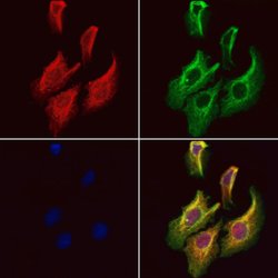 Invitrogen MYBPC1 Polyclonal Antibody 100 &mu;L; Unconjugated:Antibodies,