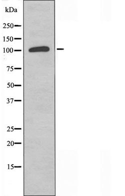 Invitrogen MYBPC1 Polyclonal Antibody 100 &mu;L; Unconjugated:Antibodies,