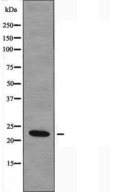 Invitrogen NDUFB9 Polyclonal Antibody 100 &mu;L | Buy Online | Invitrogen&trade; | Fisher Scientific