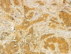 Invitrogen MT-ND5 Polyclonal Antibody 100 &mu;L | Buy Online | Invitrogen&trade; | Fisher Scientific