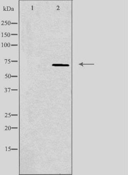 Invitrogen MT-ND5 Polyclonal Antibody 100 &mu;L | Buy Online | Invitrogen&trade; | Fisher Scientific