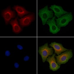 Invitrogen PTGR1 Polyclonal Antibody 100 &mu;L; Unconjugated:Antibodies,