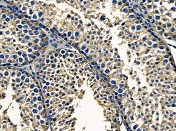 Invitrogen PTGR1 Polyclonal Antibody 100 &mu;L; Unconjugated:Antibodies,