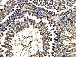 Invitrogen PTGR1 Polyclonal Antibody 100 &mu;L; Unconjugated:Antibodies,