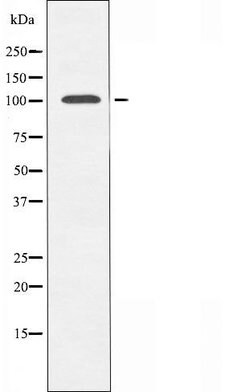 Invitrogen N4BP1 Polyclonal Antibody 100 &mu;L; Unconjugated:Antibodies,