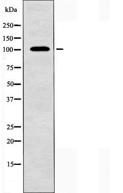 Invitrogen NCAM2 Polyclonal Antibody 100 &mu;L; Unconjugated:Antibodies,