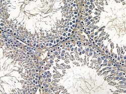 Invitrogen NPDC1 Polyclonal Antibody 100 &mu;L | Buy Online | Invitrogen&trade; | Fisher Scientific