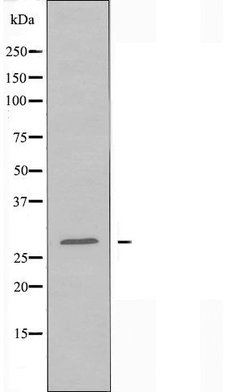 Invitrogen NPDC1 Polyclonal Antibody 100 &mu;L | Buy Online | Invitrogen&trade; | Fisher Scientific