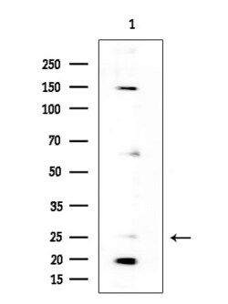 Invitrogen NPDC1 Polyclonal Antibody 100 &mu;L | Buy Online | Invitrogen&trade; | Fisher Scientific