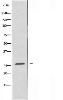 Invitrogen NRL Polyclonal Antibody 100 &mu;L | Buy Online | Invitrogen&trade; | Fisher Scientific