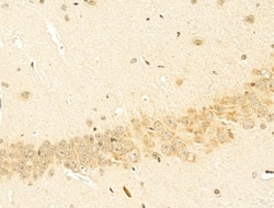Invitrogen NBPF Pan Polyclonal Antibody 100 &mu;L; Unconjugated:Antibodies,