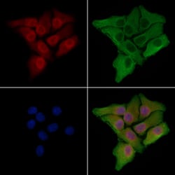 Invitrogen NOL10 Polyclonal Antibody 100 &mu;L | Buy Online | Invitrogen&trade; | Fisher Scientific