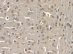 Invitrogen NOL10 Polyclonal Antibody 100 &mu;L | Buy Online | Invitrogen&trade; | Fisher Scientific