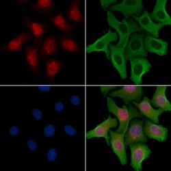 Invitrogen OGFR Polyclonal Antibody 100 &mu;L; Unconjugated:Antibodies,
