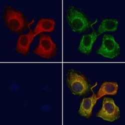 Invitrogen SLC22A3 Polyclonal Antibody 100 &mu;L | Buy Online | Invitrogen&trade; | Fisher Scientific
