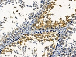 Invitrogen SLC6A15 Polyclonal Antibody 100 &mu;L; Unconjugated:Antibodies,