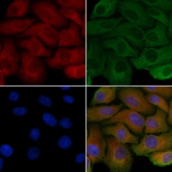 Invitrogen PDRG1 Polyclonal Antibody 100 &mu;L; Unconjugated:Antibodies,