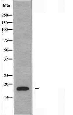 Invitrogen PDRG1 Polyclonal Antibody 100 &mu;L; Unconjugated:Antibodies,