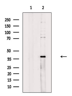 Invitrogen ZDHHC15 Polyclonal Antibody 100 &mu;L; Unconjugated:Antibodies,