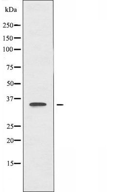 Invitrogen DECR2 Polyclonal Antibody 100 &mu;L | Buy Online | Invitrogen&trade; | Fisher Scientific