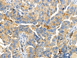 Invitrogen PEX10 Polyclonal Antibody 100 &mu;L; Unconjugated:Antibodies,
