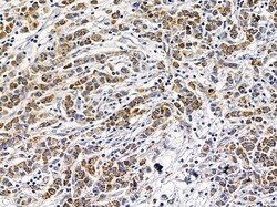 Invitrogen PHACTR4 Polyclonal Antibody 100 &mu;L; Unconjugated:Antibodies,