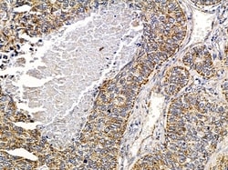 Invitrogen PHACTR4 Polyclonal Antibody 100 &mu;L; Unconjugated:Antibodies,