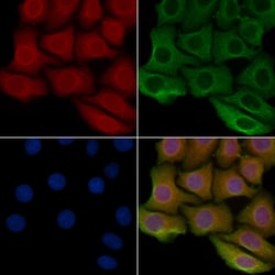 Invitrogen PITPNB Polyclonal Antibody 100 &mu;L; Unconjugated:Antibodies,