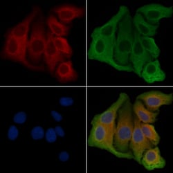 Invitrogen PKP4 Polyclonal Antibody 100 &mu;L; Unconjugated:Antibodies,