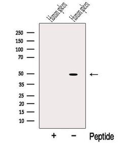 Invitrogen Protein C Inhibitor Polyclonal Antibody 100 &mu;L; Unconjugated:Antibodies,