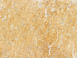 Invitrogen Protein C Inhibitor Polyclonal Antibody 100 &mu;L; Unconjugated:Antibodies,