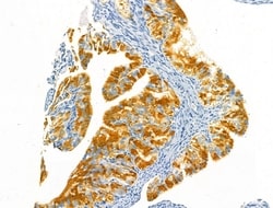 Invitrogen Protein C Inhibitor Polyclonal Antibody 100 &mu;L; Unconjugated:Antibodies,