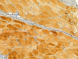 Invitrogen Protein C Inhibitor Polyclonal Antibody 100 &mu;L; Unconjugated:Antibodies,
