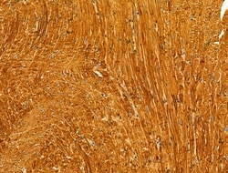 Invitrogen Protein C Inhibitor Polyclonal Antibody 100 &mu;L; Unconjugated:Antibodies,