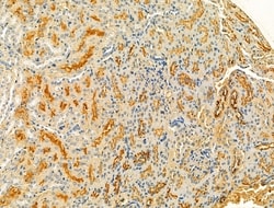 Invitrogen Protein C Inhibitor Polyclonal Antibody 100 &mu;L; Unconjugated:Antibodies,