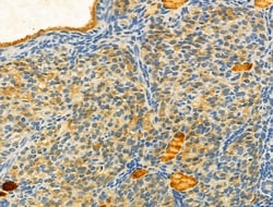Invitrogen Protein C Inhibitor Polyclonal Antibody 100 &mu;L; Unconjugated:Antibodies,