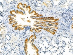 Invitrogen Protein C Inhibitor Polyclonal Antibody 100 &mu;L; Unconjugated:Antibodies,