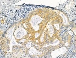 Invitrogen Protein C Inhibitor Polyclonal Antibody 100 &mu;L; Unconjugated:Antibodies,