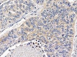 Invitrogen Nectin 4 Polyclonal Antibody 100 &mu;L; Unconjugated:Antibodies,