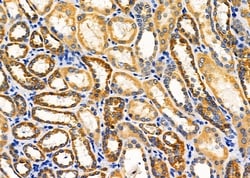 Invitrogen KCNK1 Polyclonal Antibody 100 &mu;L; Unconjugated:Antibodies,