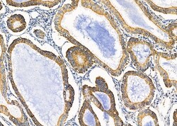 Invitrogen KCNK1 Polyclonal Antibody 100 &mu;L; Unconjugated:Antibodies,