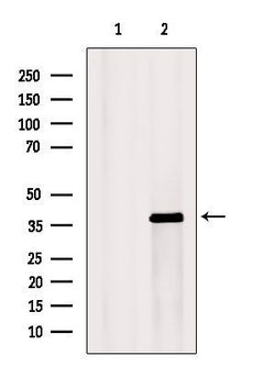 Invitrogen KCNK1 Polyclonal Antibody 100 &mu;L; Unconjugated:Antibodies,