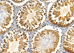 Invitrogen KCNK12 Polyclonal Antibody 100 &mu;L; Unconjugated:Antibodies,