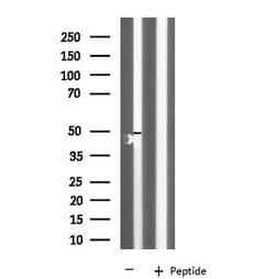 Invitrogen KCNK12 Polyclonal Antibody 100 &mu;L; Unconjugated:Antibodies,