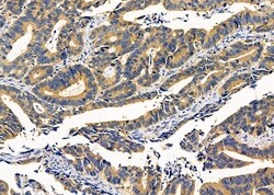 Invitrogen KCNK17 Polyclonal Antibody 100 &mu;L; Unconjugated:Antibodies,