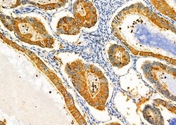 Invitrogen KCNK17 Polyclonal Antibody 100 &mu;L; Unconjugated:Antibodies,