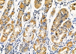 Invitrogen KCNK4 Polyclonal Antibody 100 &mu;L; Unconjugated:Antibodies,