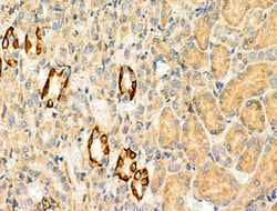 Invitrogen KV1.5 (KCNA5) Polyclonal Antibody 100 &mu;L; Unconjugated:Antibodies,